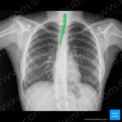 Advanced Chest X-ray Image Validator & Quality Screener logo